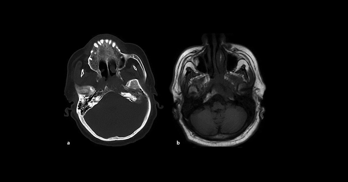 Spot The Complication From Images