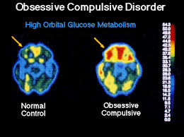 OCD And Pregnancy