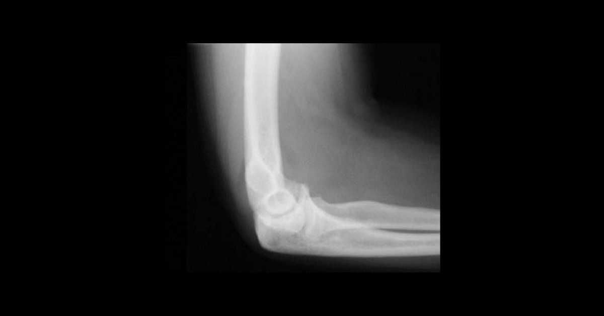 Interpret These Radiologic Findings