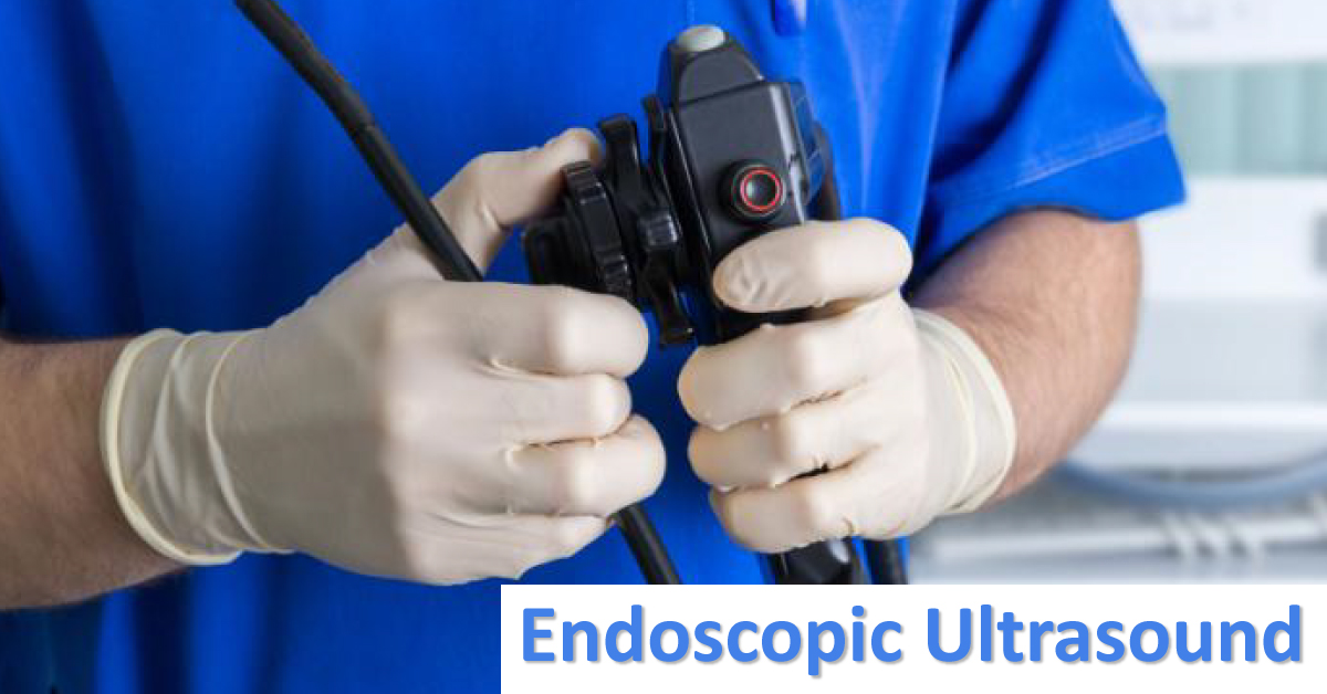 Emerging Indications Of Endoscopic Ultrasound