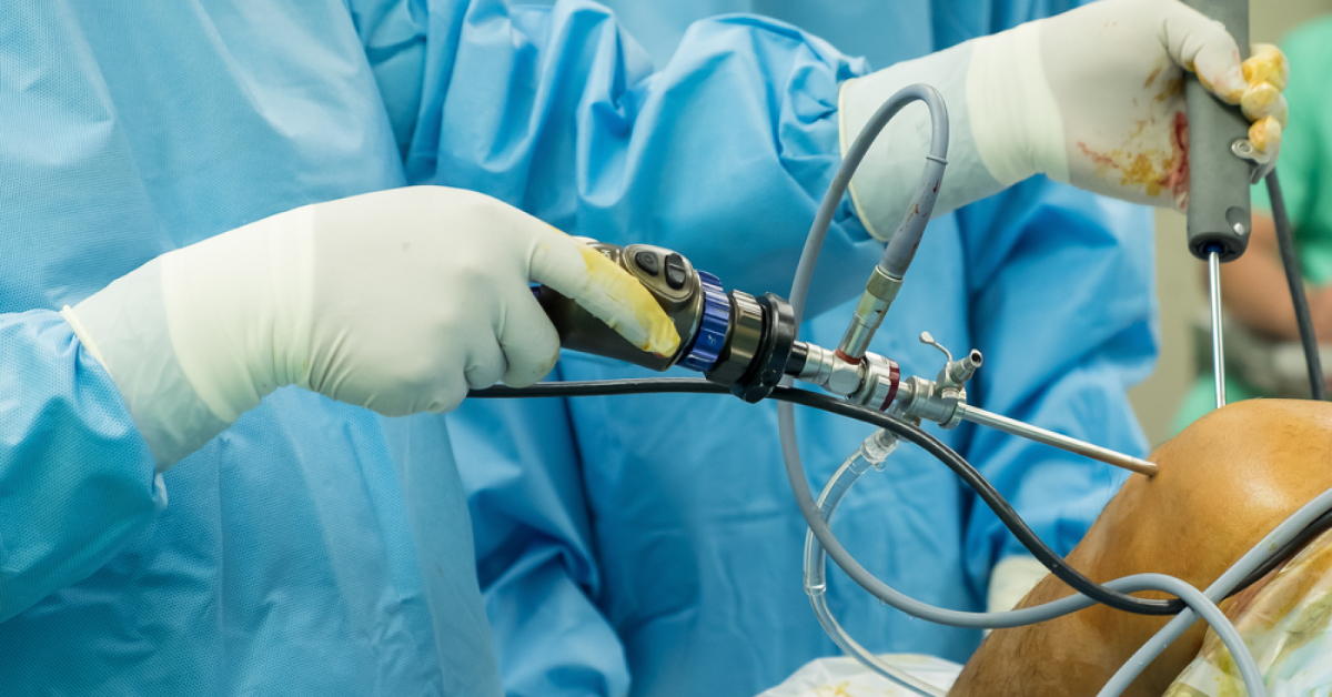 Arthroscopic Surgery For OA Knees And Bucket Handle Medial Meniscal Tears