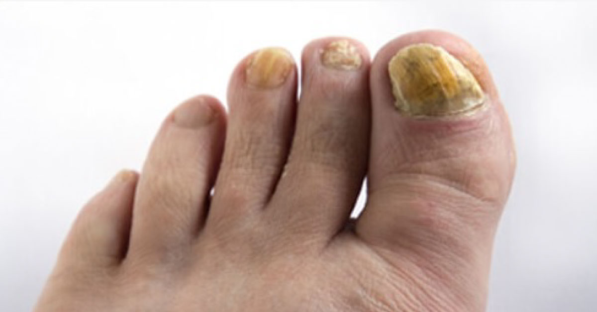 Spot The Condition