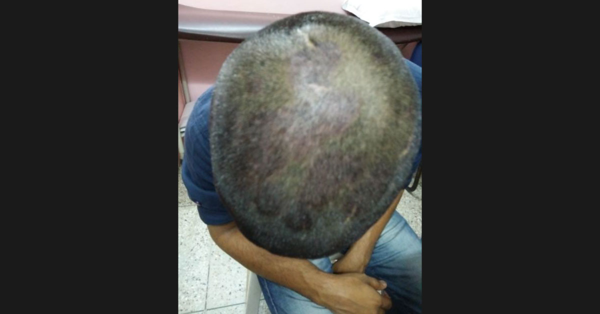 Diagnose This Scalp Condition?