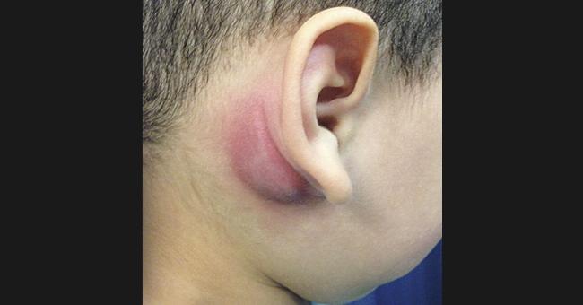 Auricular Region