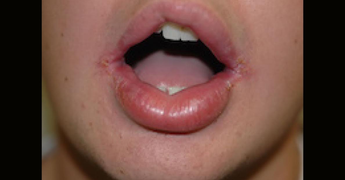 Spot The Dermatological Condition