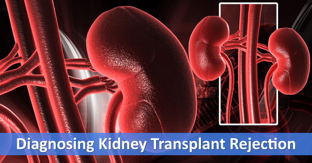 Diagnosing Kidney Transplant Rejection Using Diagnostic Imaging