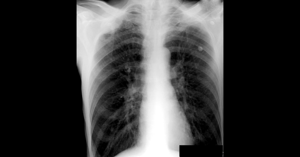 What Is Your Opinion From Radiographs?