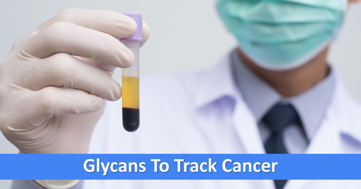 Glycans To Accurately Track Early Cancer
