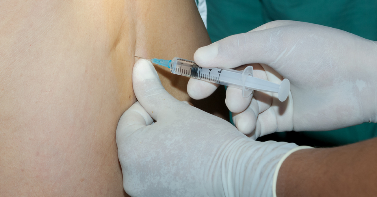 Trends In Local Anesthetics