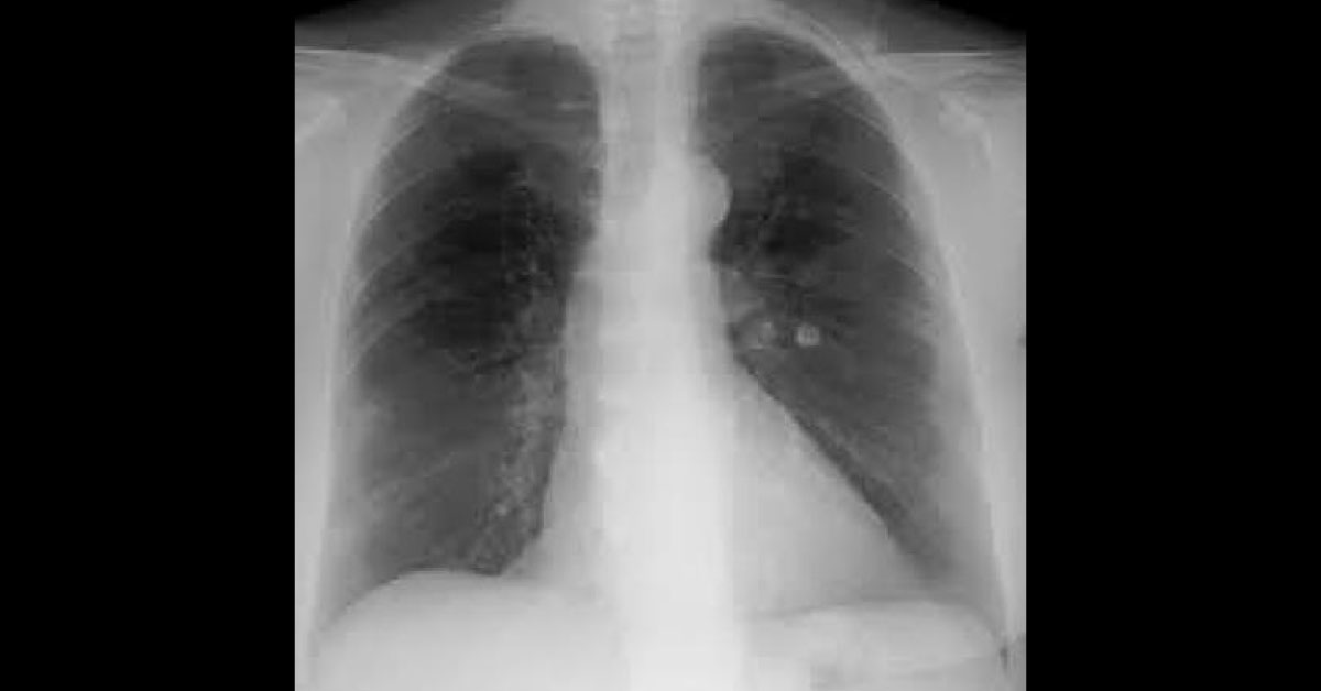 Interpret The Radiological Findings