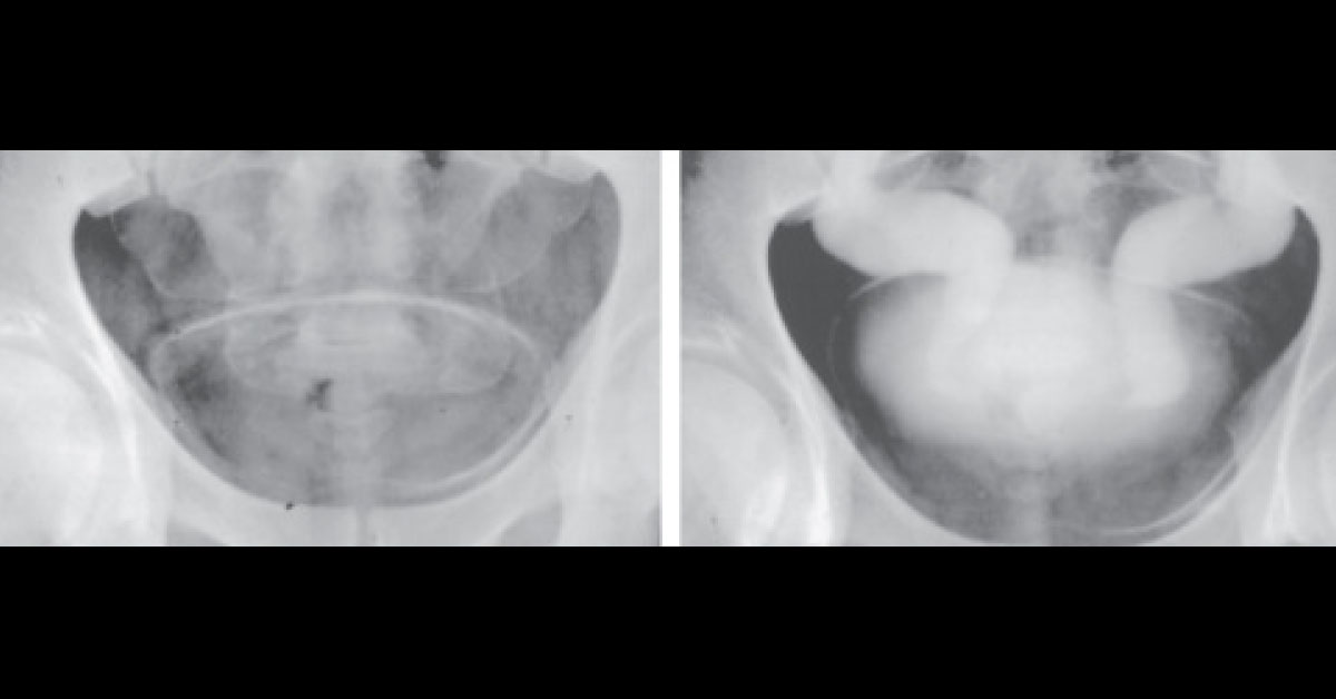 Identify This Urological Condition