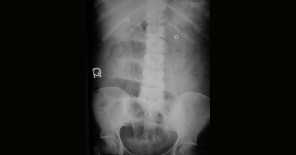 Identify The Condition