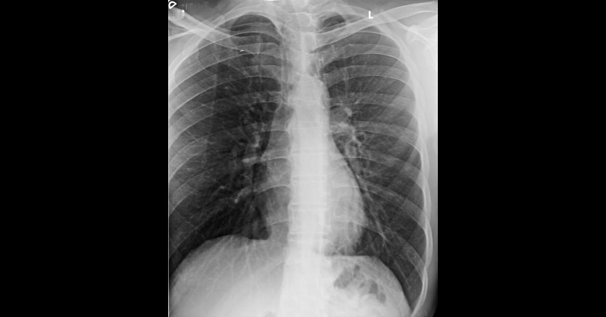 Spot The Diagnosis?