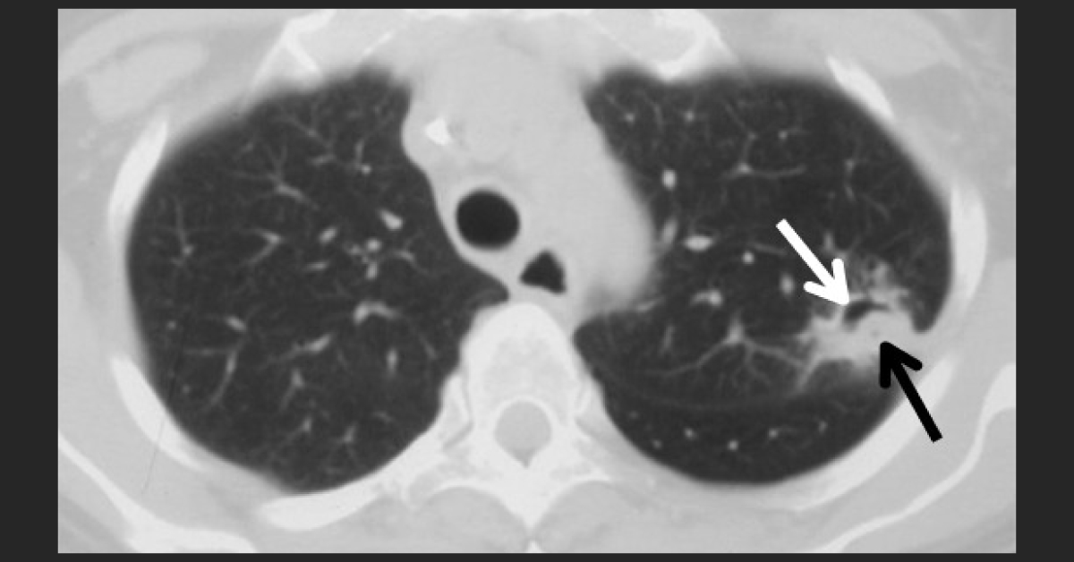 Name This Sign From Radiographs