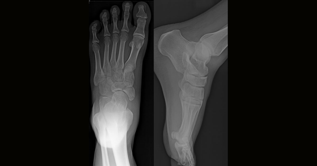 Interpret The X-Ray Findings