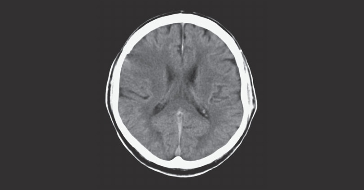 Interpret This CT Scan