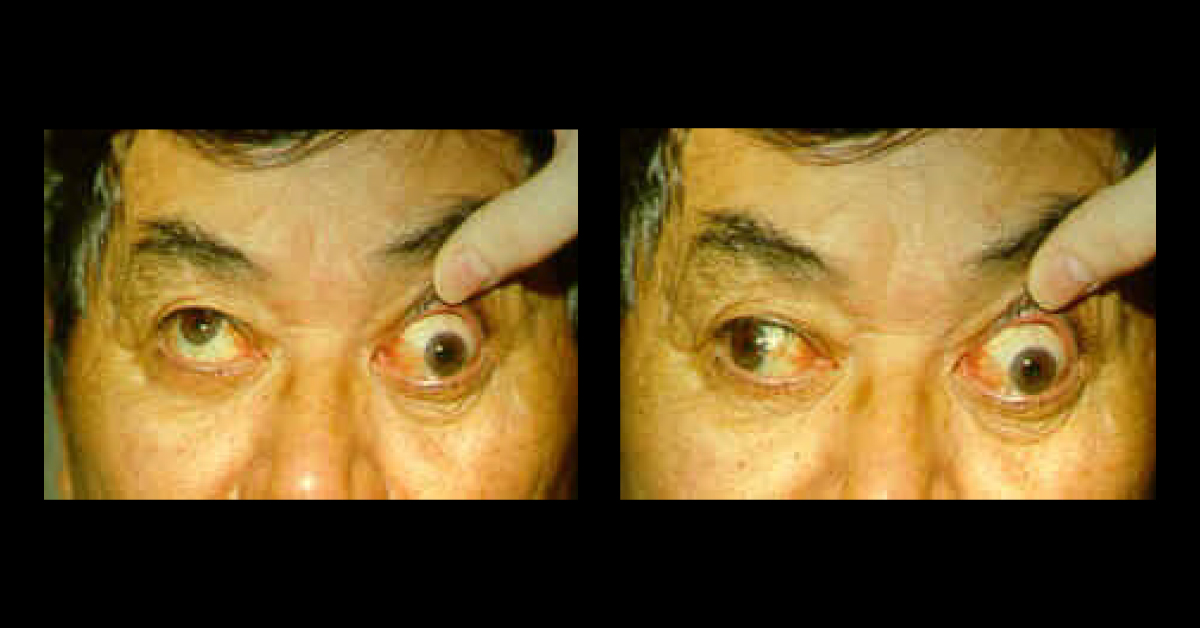 Identify The Medical Condition