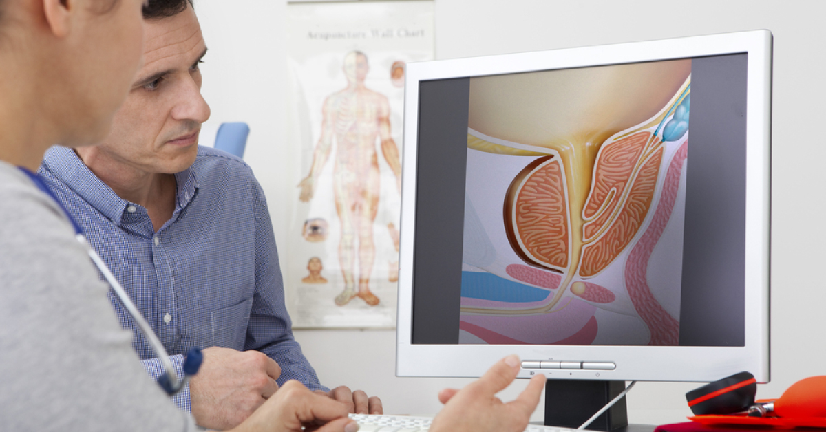Solve This Case Related To Prostate Cancer