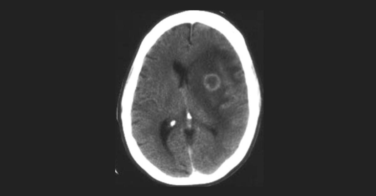 Interpret These Radiologic Findings