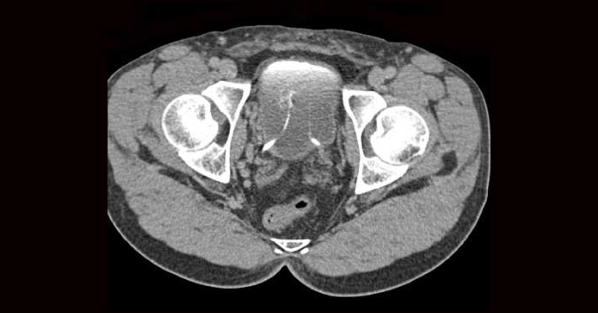Clinical Case Challenge