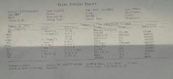 Fever With Vomiting In A 5 Months Old Girl