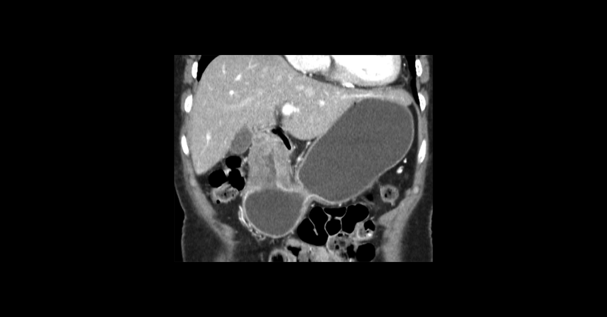 Interpret These Abdominopelvic CT Findings