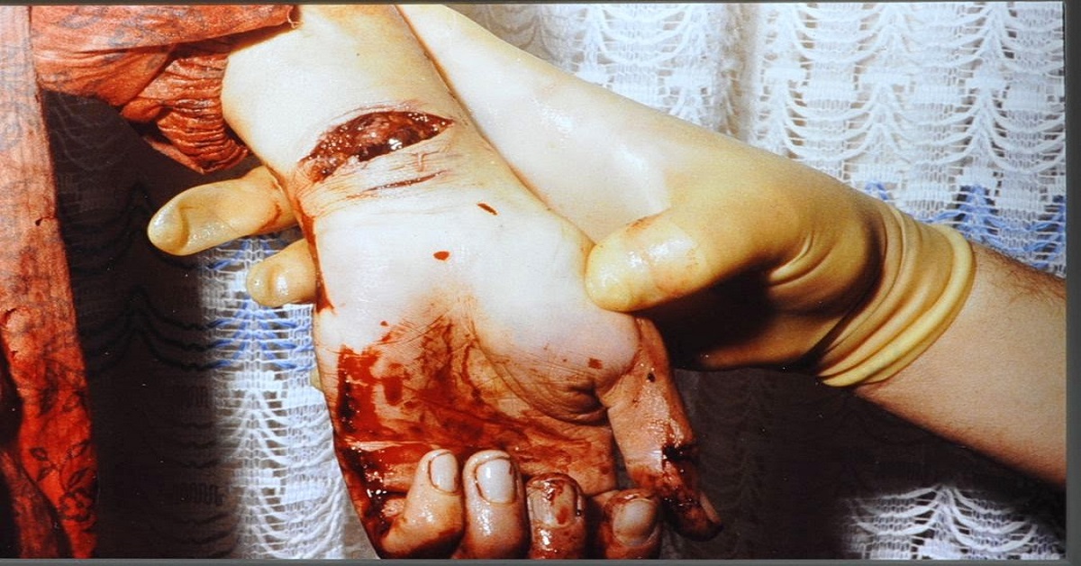 Is This Case Suicidal Or Homicidal?