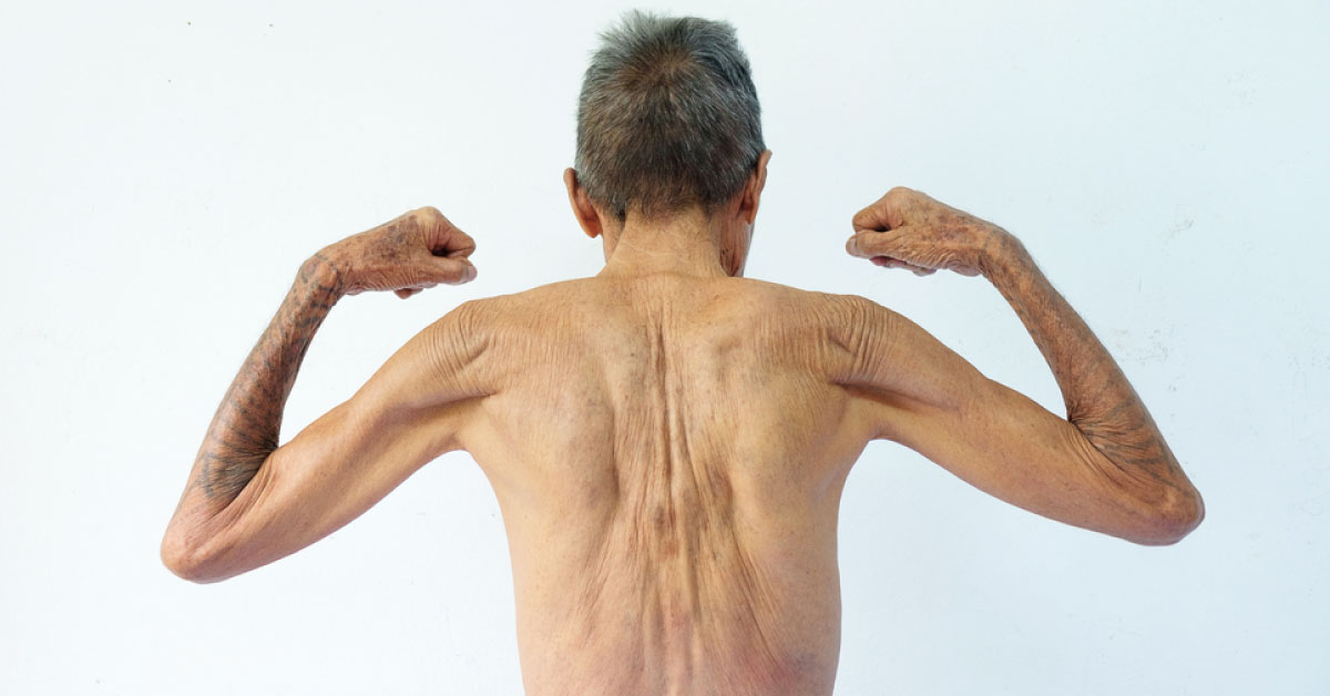 Changes In Fat, Muscle, And Bones In Aging Human Body