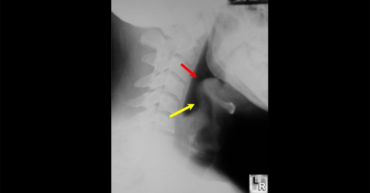 Identify This Condition In A Young Boy