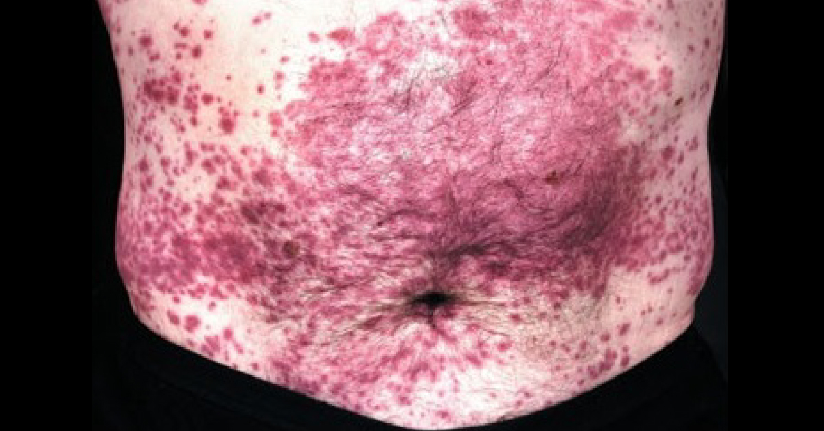 Spot The Dermatological Condition