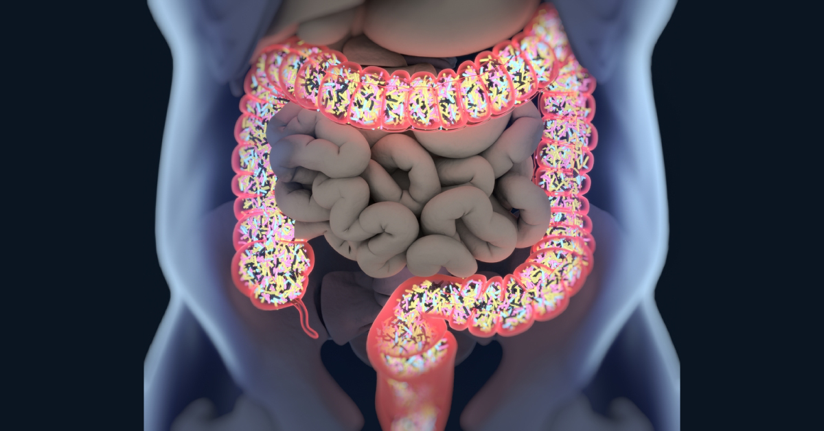 Can Bacterial Infection Promote Colorectal Cancer?