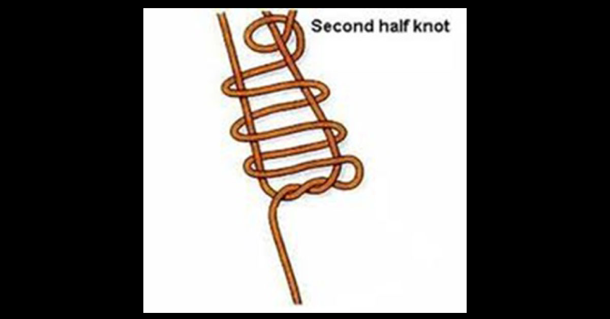 Tightening Of Seton Using Roeder’s Knot In Complex Fistula - In - Ano: With Knot Pusher