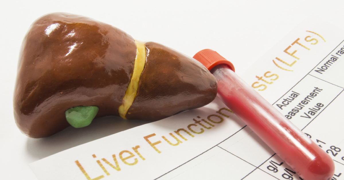 Are Cytotoxic Bilirubin Metabolites Overlooked