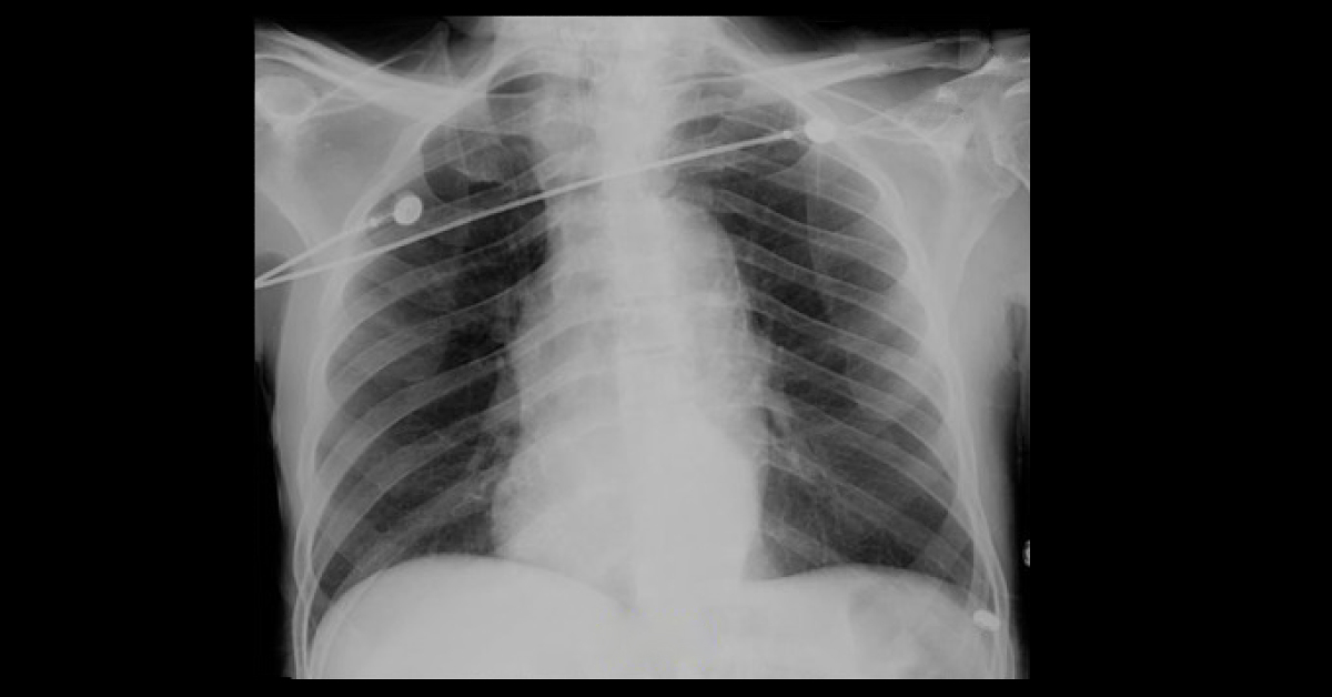 Apply Your Knowledge, Interpret These Radiographs