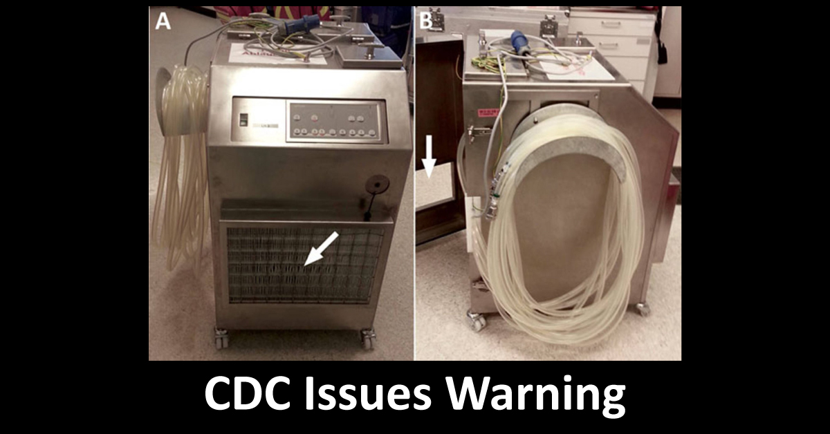 CDC Releases Warning For Global Outbreak Against Factory Contamination Of Heater-Cooler Unit