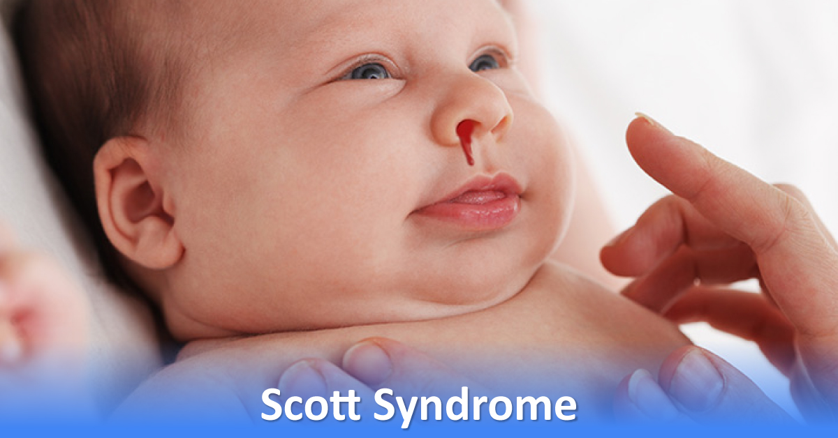 Hematology Rare Disease, Scott Syndrome
