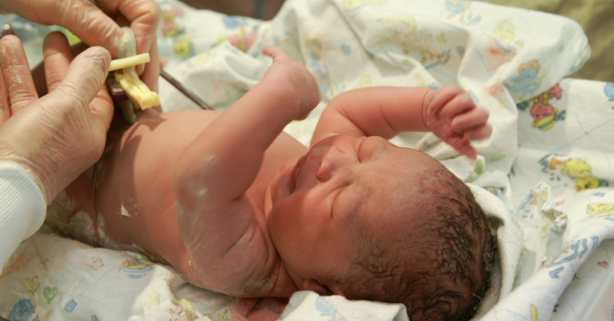 Delayed Cord Clamping