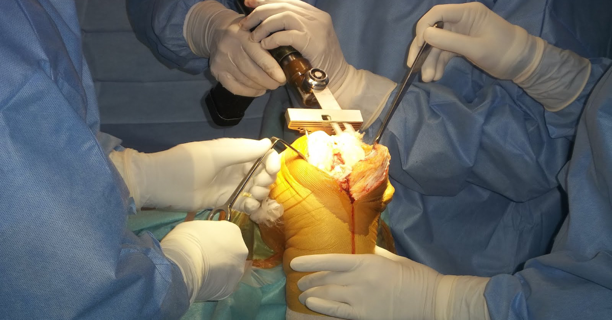 Anesthesia For Bone Replacement Surgery