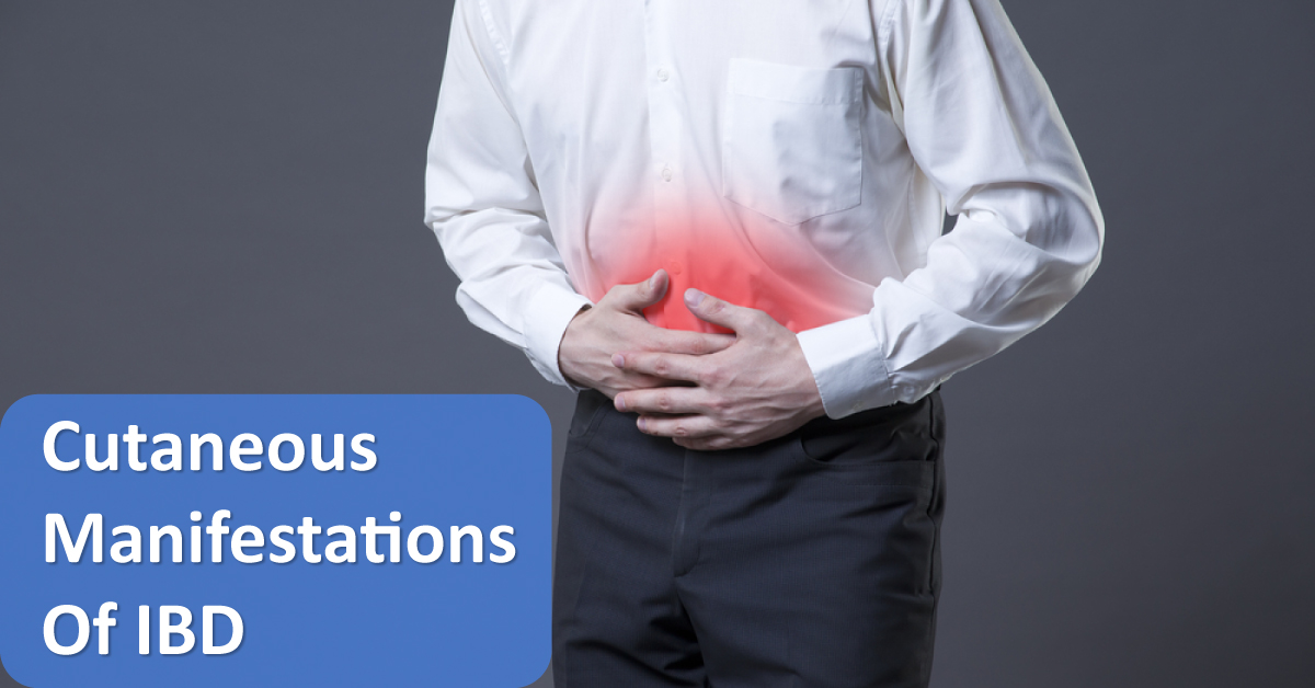 Skin Manifestations Of Inflammatory Bowel Disease