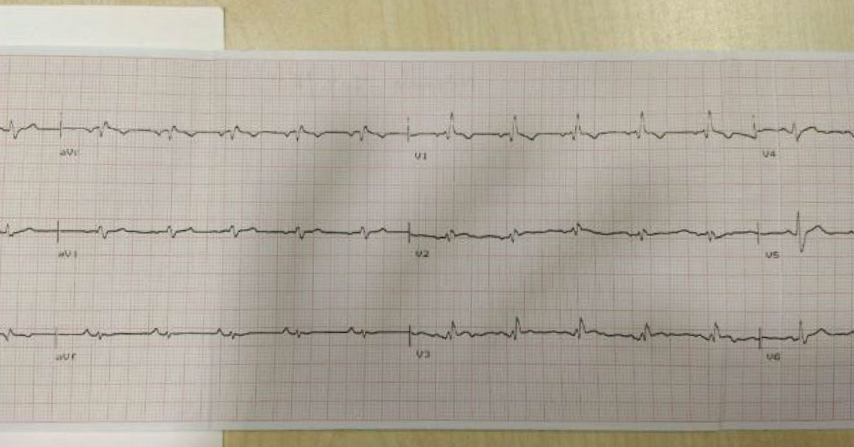 Management Of This Cardiac Condition