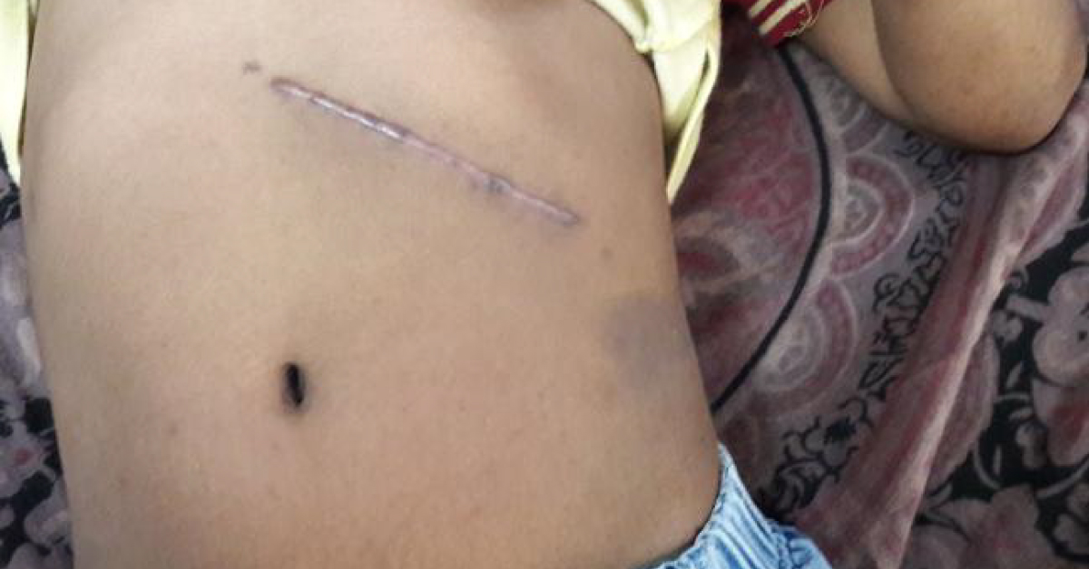 Difficult Case Of Bleeding Disorder