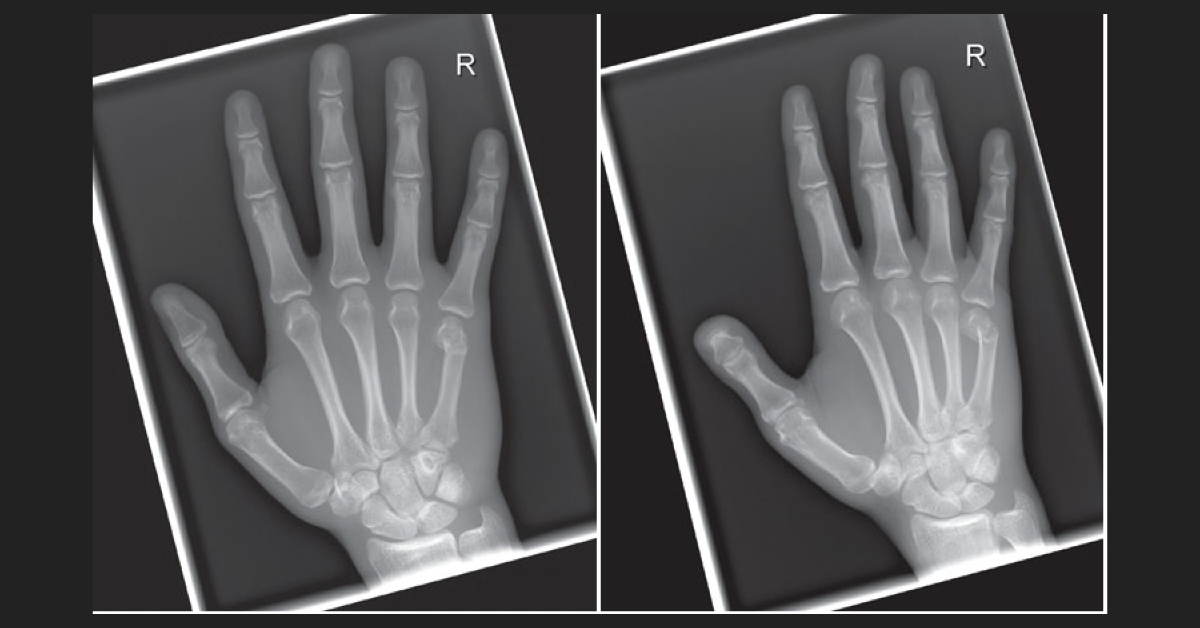 Interpret These Radiographs