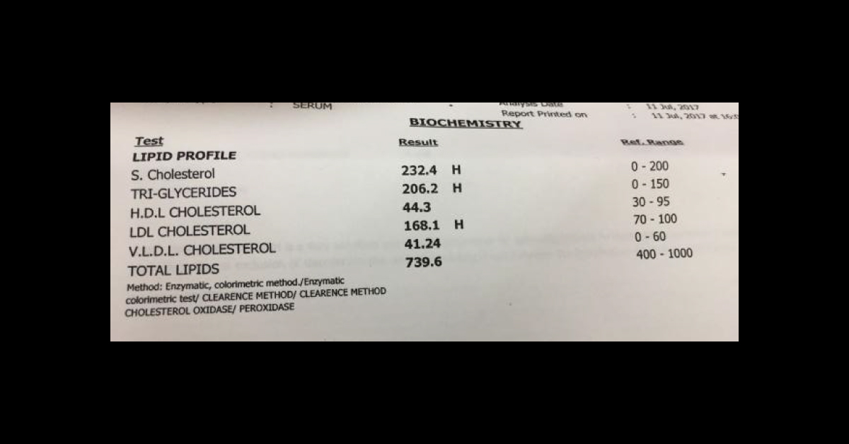 Is This A Syndrome Or Indicative Of CAD In Young Boy?