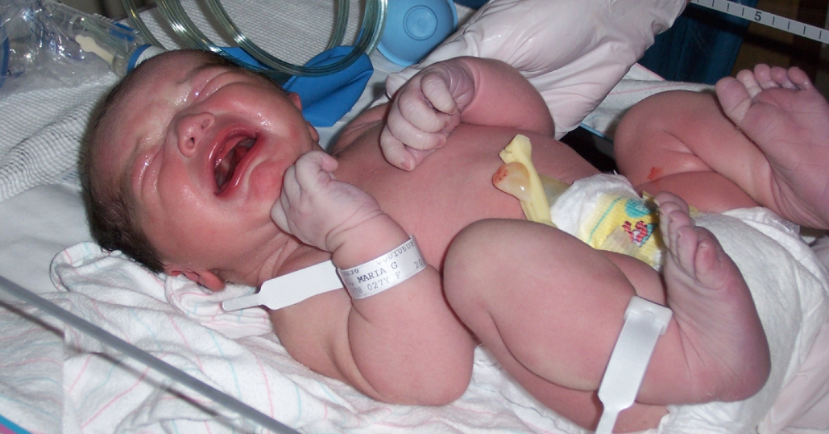 Critical Case Of Persistent Vomiting In A Neonate