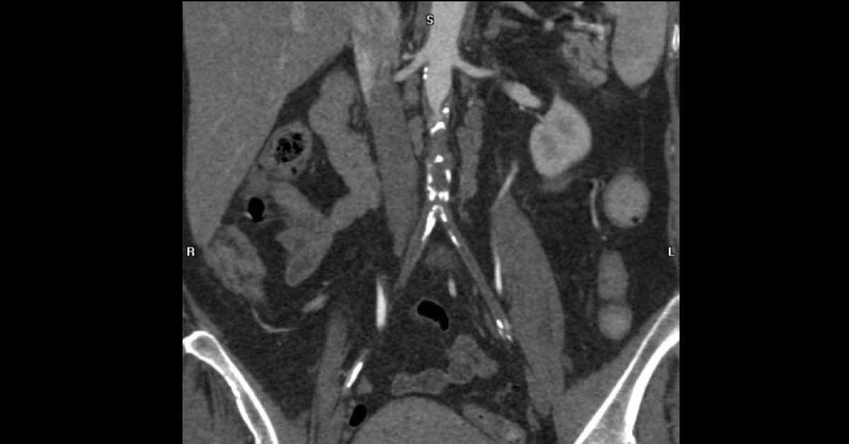 What Is Your Diagnosis From Radiograph