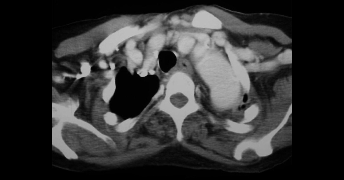 Interpret The Radiograph