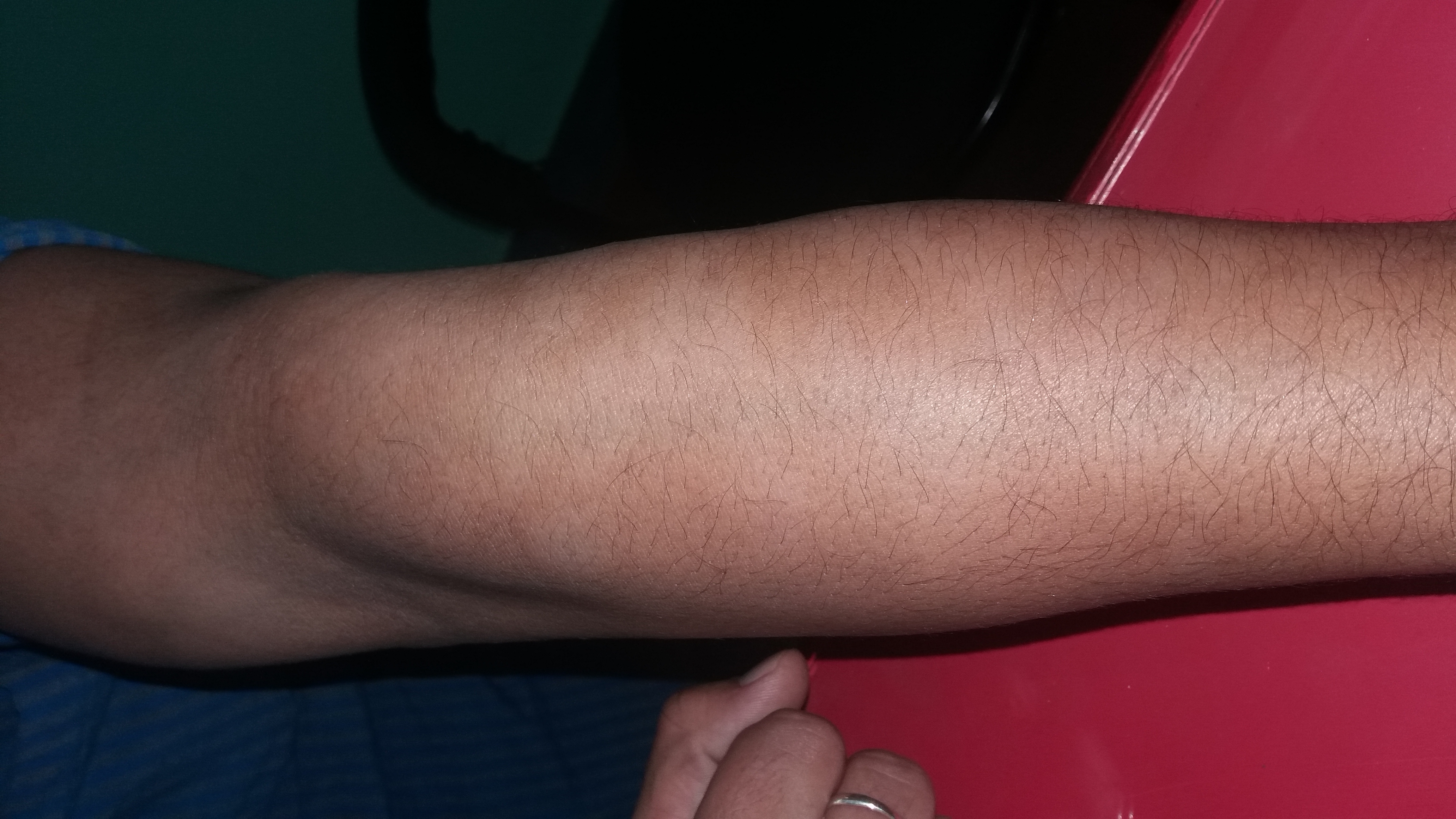 Identify The Cause And Management