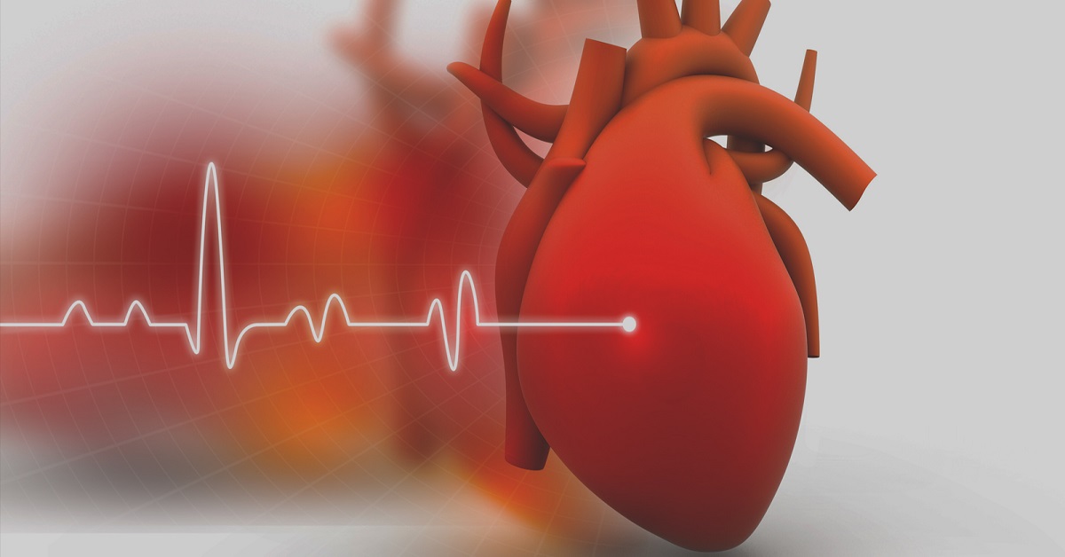 Case Of Rheumatic Mitral Stenosis