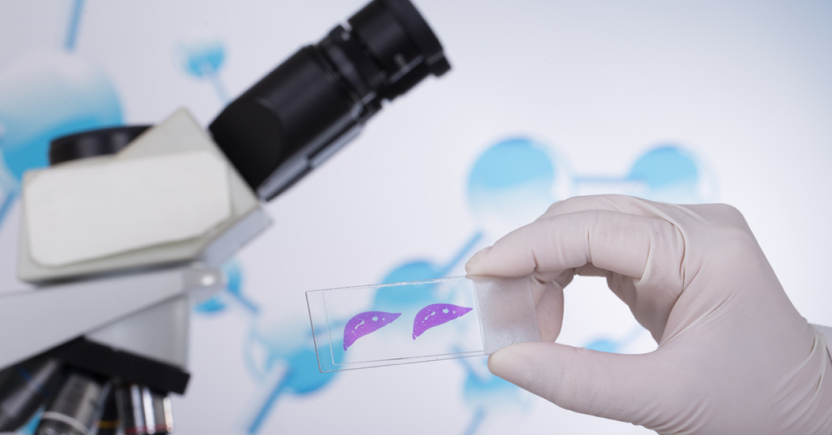 Medical Devices Induced Infection