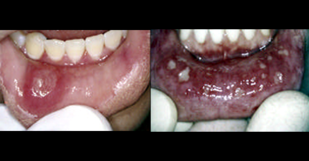 Spot The Oral Condition